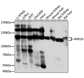 Western Blot - Anti-RNF20 Antibody (A87949) - Antibodies.com