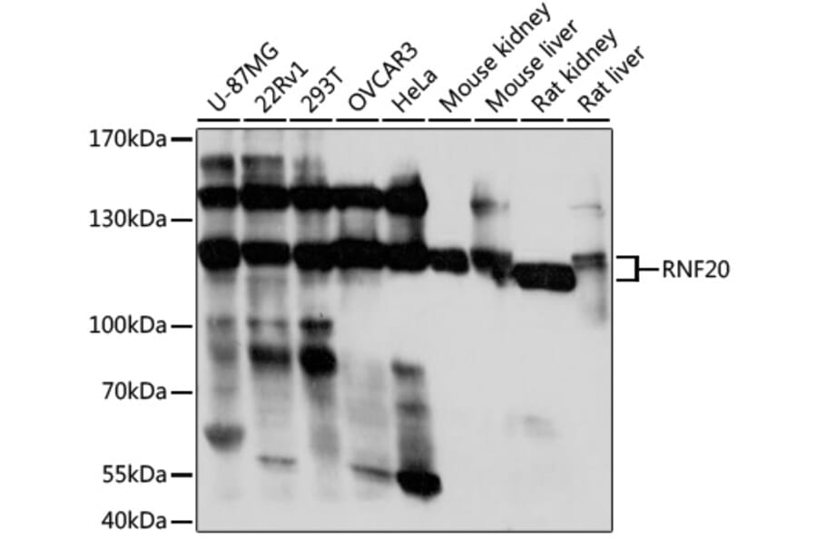Western Blot - Anti-RNF20 Antibody (A87949) - Antibodies.com