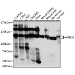 Western Blot - Anti-RNF20 Antibody (A87949) - Antibodies.com