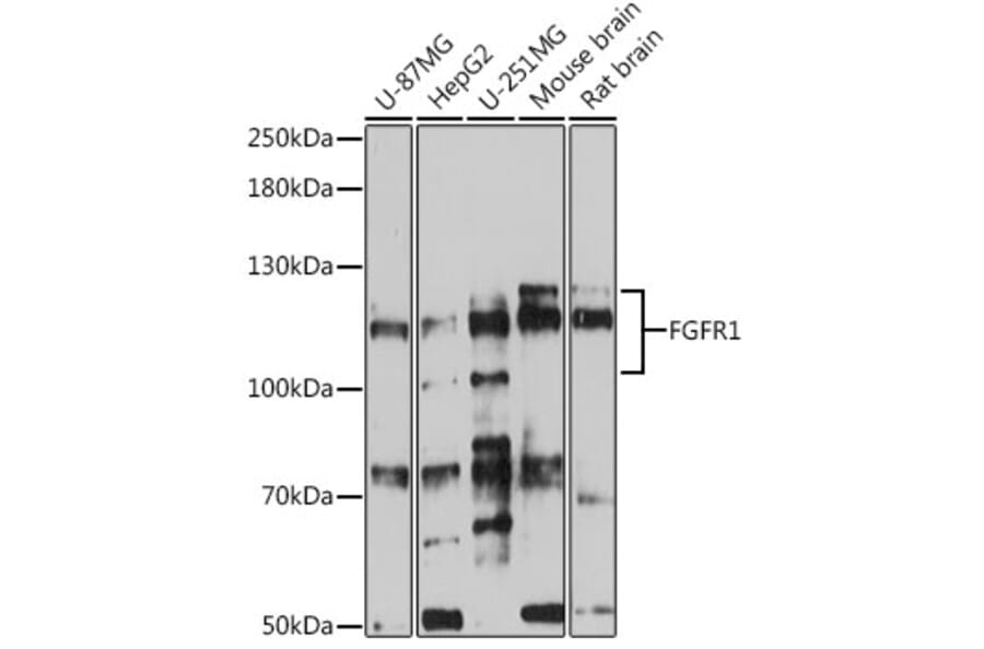 Western Blot - Anti-FGFR1 Antibody (A87950) - Antibodies.com
