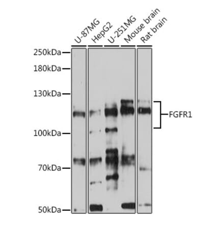 Western Blot - Anti-FGFR1 Antibody (A87950) - Antibodies.com