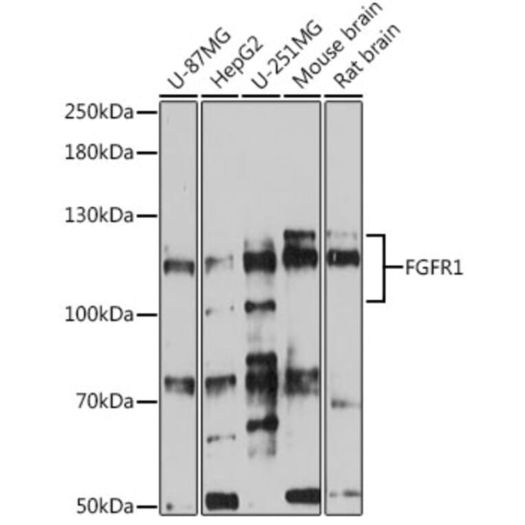 Western Blot - Anti-FGFR1 Antibody (A87950) - Antibodies.com