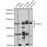 Western Blot - Anti-FGFR1 Antibody (A87950) - Antibodies.com