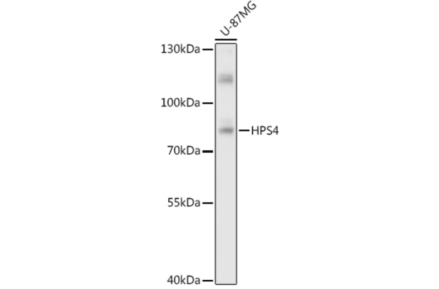 Western Blot - Anti-HPS4 Antibody (A87951) - Antibodies.com