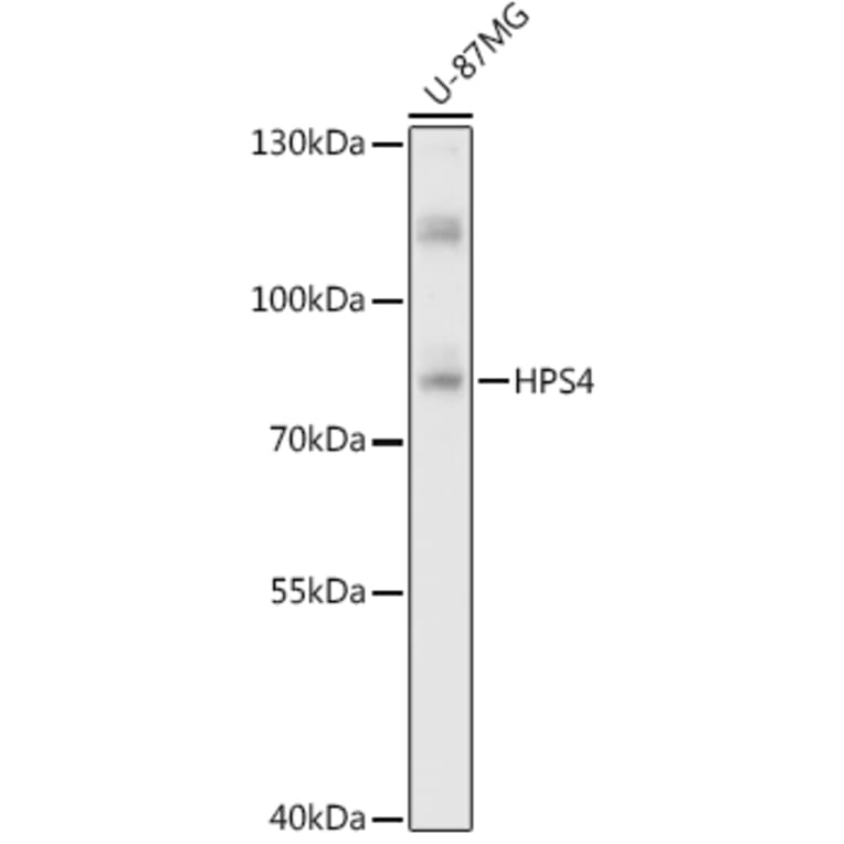 Western Blot - Anti-HPS4 Antibody (A87951) - Antibodies.com