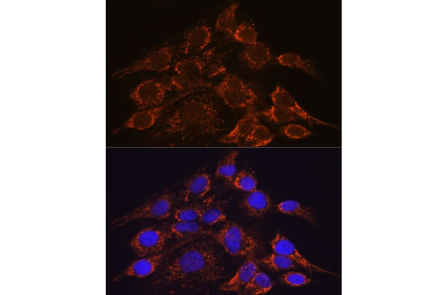 Immunofluorescence - Anti-HPS4 Antibody (A87951) - Antibodies.com