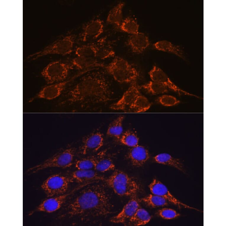 Immunofluorescence - Anti-HPS4 Antibody (A87951) - Antibodies.com