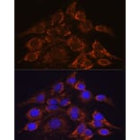 Immunofluorescence - Anti-HPS4 Antibody (A87951) - Antibodies.com