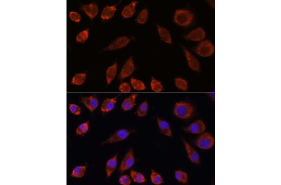 Immunofluorescence - Anti-HPS4 Antibody (A87951) - Antibodies.com