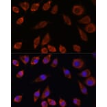 Immunofluorescence - Anti-HPS4 Antibody (A87951) - Antibodies.com