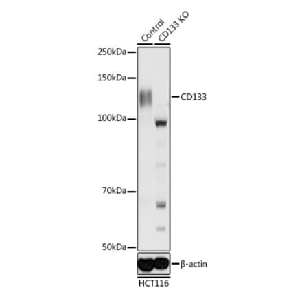 Western Blot - Anti-CD133 Antibody (A87952) - Antibodies.com