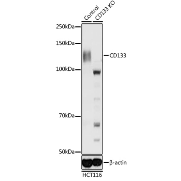 Western Blot - Anti-CD133 Antibody (A87952) - Antibodies.com
