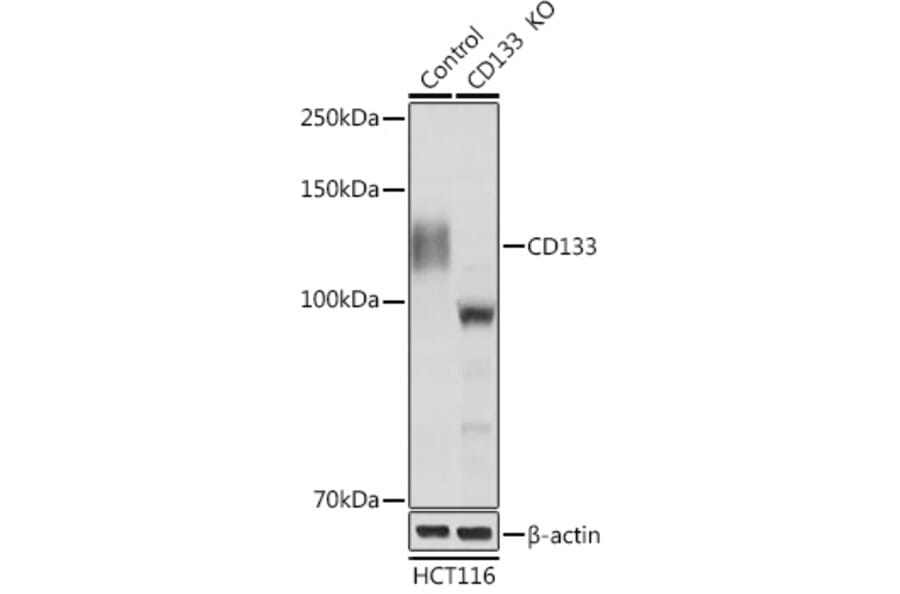 Western Blot - Anti-CD133 Antibody (A87952) - Antibodies.com