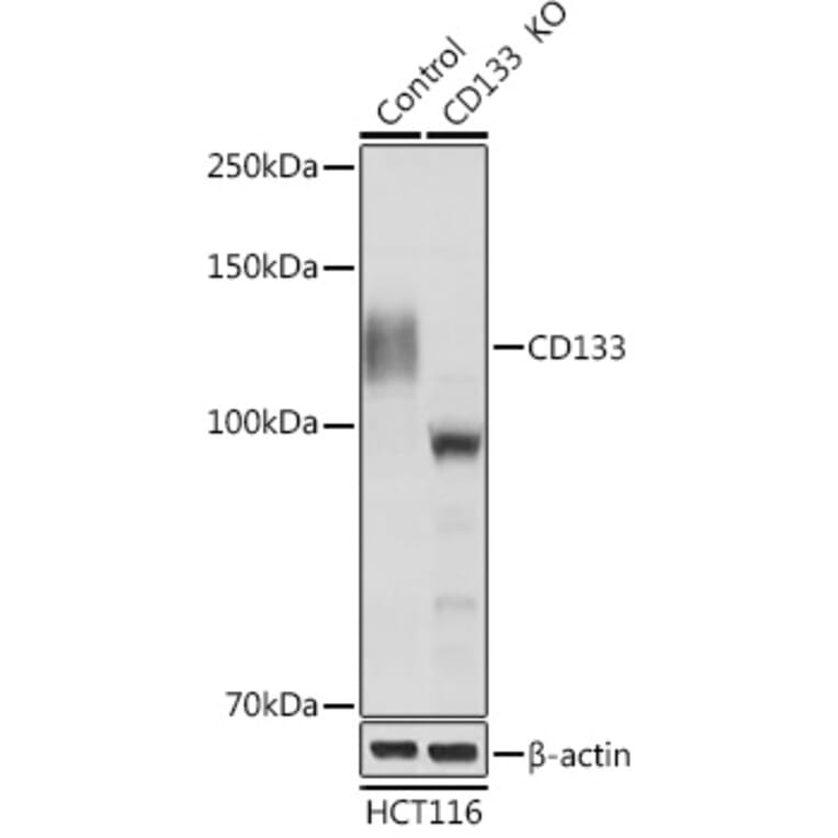 Western Blot - Anti-CD133 Antibody (A87952) - Antibodies.com