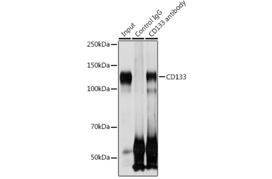 Western Blot - Anti-CD133 Antibody (A87952) - Antibodies.com