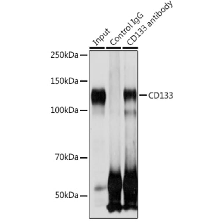 Western Blot - Anti-CD133 Antibody (A87952) - Antibodies.com