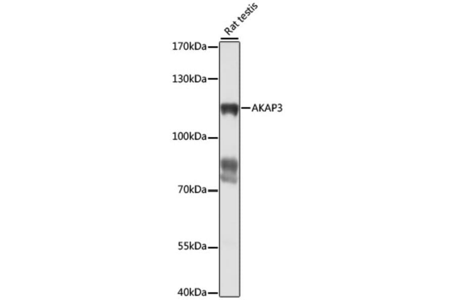Western Blot - Anti-AKAP3 Antibody (A87954) - Antibodies.com