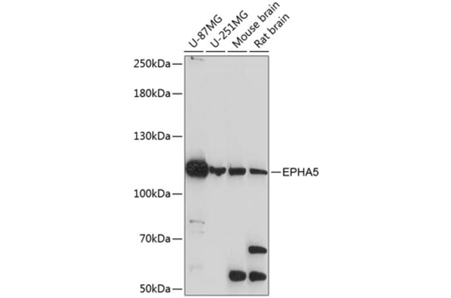 Western Blot - Anti-Eph receptor A5/BSK Antibody (A87955) - Antibodies.com