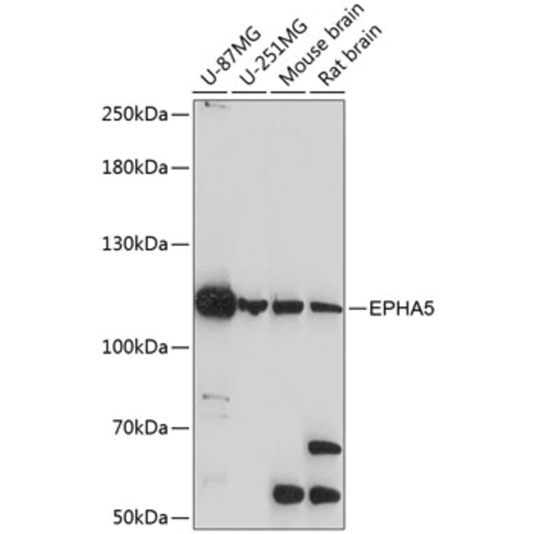 Western Blot - Anti-Eph receptor A5/BSK Antibody (A87955) - Antibodies.com