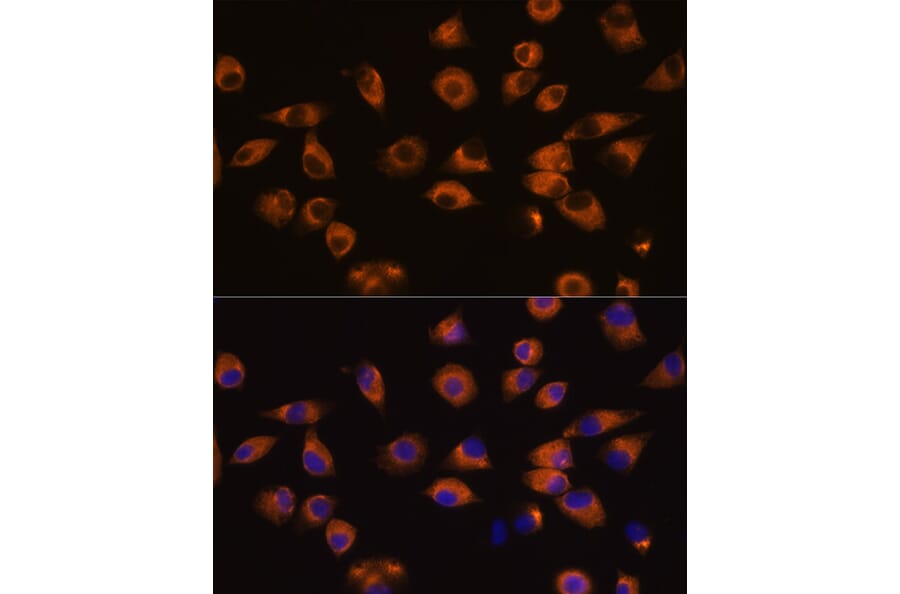 Immunofluorescence - Anti-Eph receptor A5/BSK Antibody (A87955) - Antibodies.com