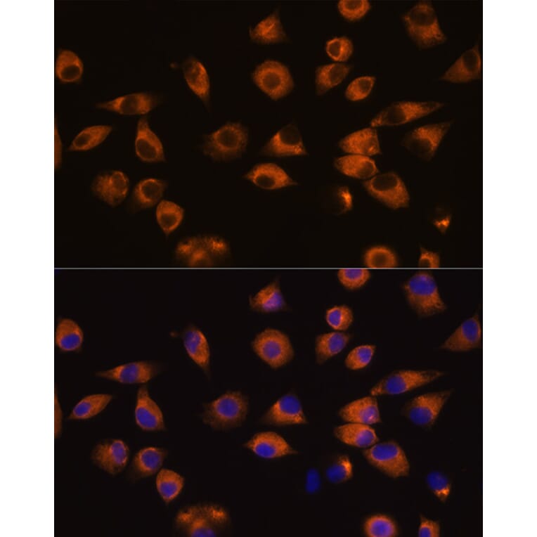 Immunofluorescence - Anti-Eph receptor A5/BSK Antibody (A87955) - Antibodies.com
