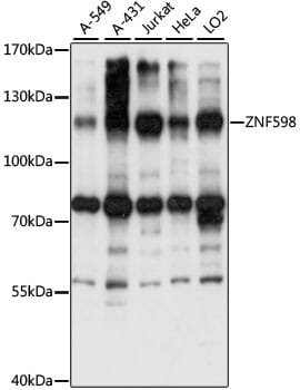 Western blot analysis of extracts of various cell lines, using Anti-ZNF598 Antibody (A15546) at 1:1,000 dilution.
Secondary antibody: Goat Anti-Rabbit IgG (H+L) (HRP) (AS014) at 1:10,000 dilution.
Lysates / proteins: 25µg per lane.
Blocking buffer: 3% non-fat dry milk in TBST.
Detection: ECL Basic Kit (RM00020).
Exposure time: 15S.