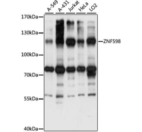 Western Blot - Anti-ZNF598 Antibody (A87956) - Antibodies.com