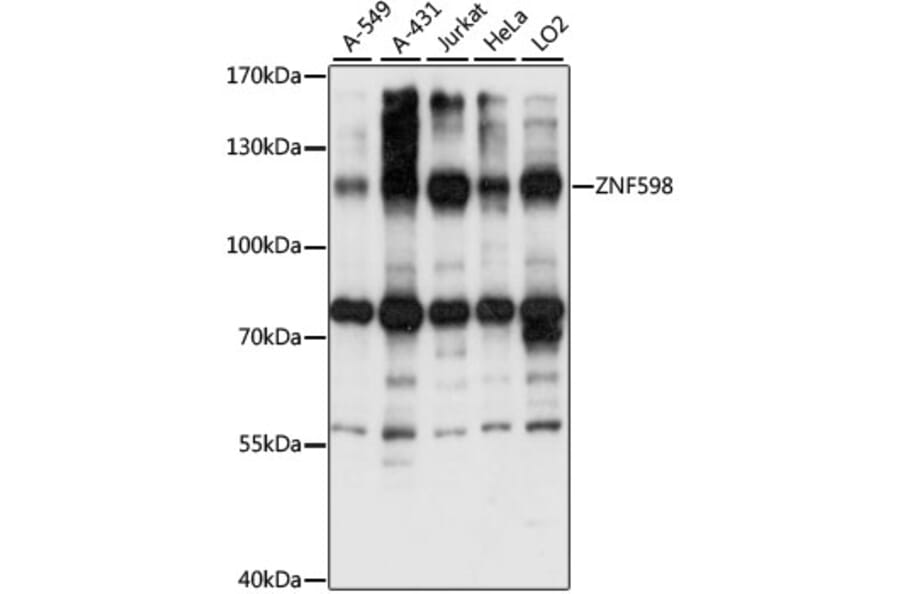 Western Blot - Anti-ZNF598 Antibody (A87956) - Antibodies.com
