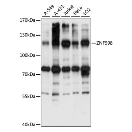 Western Blot - Anti-ZNF598 Antibody (A87956) - Antibodies.com