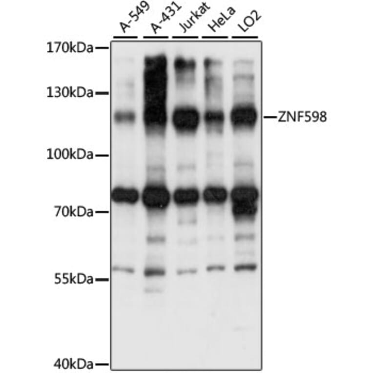Western Blot - Anti-ZNF598 Antibody (A87956) - Antibodies.com