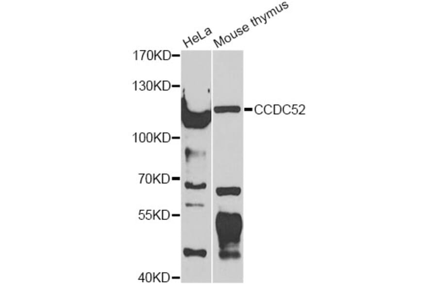 Western Blot - Anti-CCDC52 Antibody (A12611) - Antibodies.com