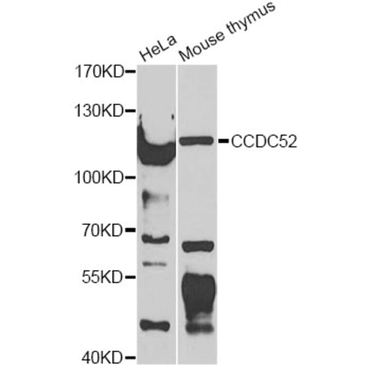 Western Blot - Anti-CCDC52 Antibody (A12611) - Antibodies.com