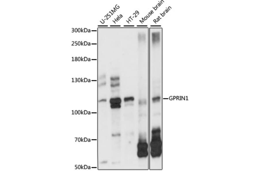 Western Blot - Anti-GRIN1 Antibody (A87958) - Antibodies.com