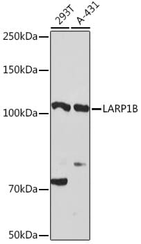 Western blot analysis of extracts of various cell lines, using Anti-LARP1B Antibody (A13222) at 1:3000 dilution.
Secondary antibody: Goat Anti-Rabbit IgG (H+L) (HRP) (AS014) at 1:10,000 dilution.
Lysates / proteins: 25µg per lane.
Blocking buffer: 3% non-fat dry milk in TBST.
Detection: ECL Basic Kit (RM00020).
Exposure time: 90s.