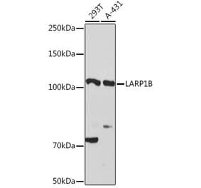 Western Blot - Anti-LARP1B Antibody (A87959) - Antibodies.com