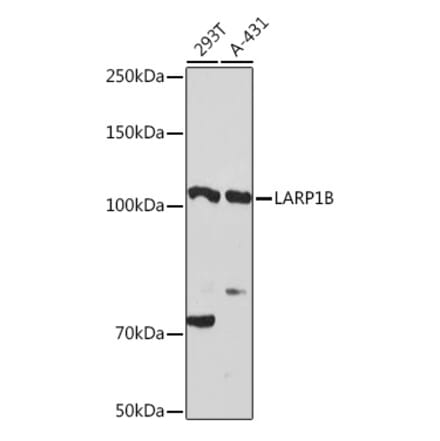 Western Blot - Anti-LARP1B Antibody (A87959) - Antibodies.com