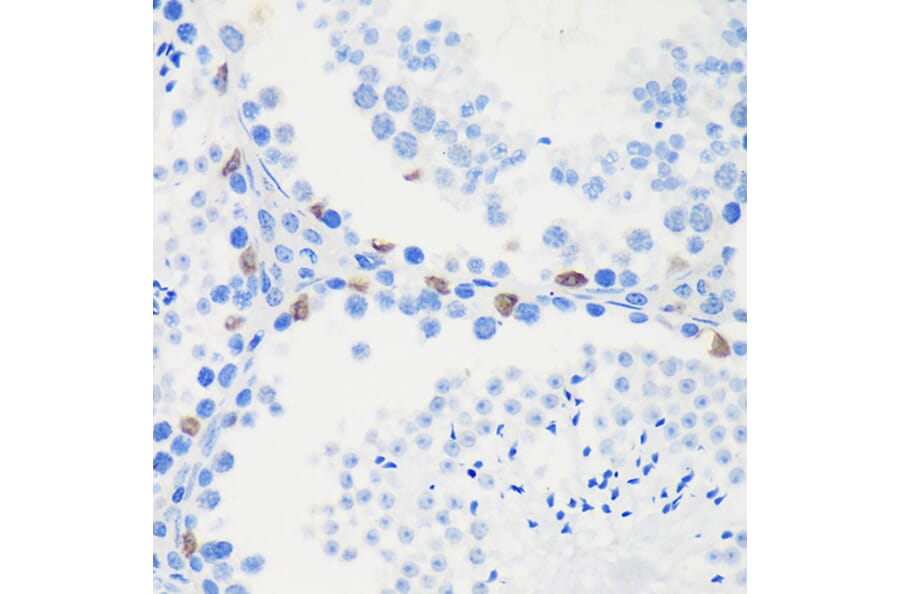 Immunohistochemistry - Anti-LARP1B Antibody (A87959) - Antibodies.com