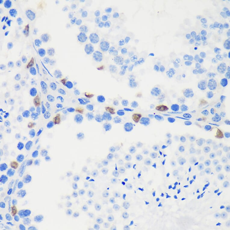 Immunohistochemistry - Anti-LARP1B Antibody (A87959) - Antibodies.com