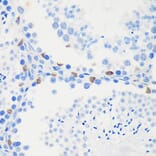 Immunohistochemistry - Anti-LARP1B Antibody (A87959) - Antibodies.com
