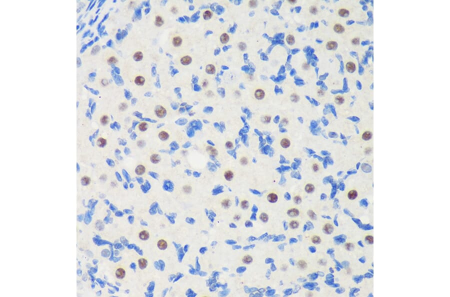 Immunohistochemistry - Anti-LARP1B Antibody (A87959) - Antibodies.com