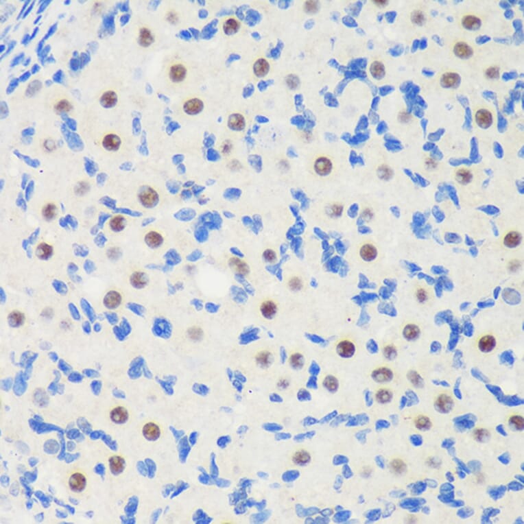 Immunohistochemistry - Anti-LARP1B Antibody (A87959) - Antibodies.com