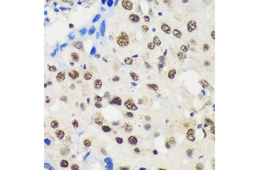 Immunohistochemistry - Anti-LARP1B Antibody (A87959) - Antibodies.com