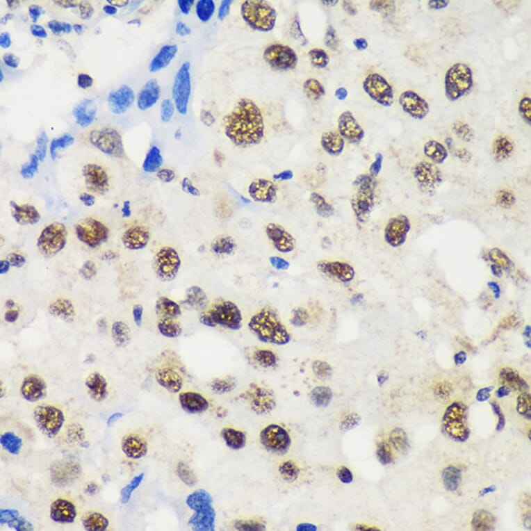 Immunohistochemistry - Anti-LARP1B Antibody (A87959) - Antibodies.com