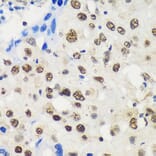 Immunohistochemistry - Anti-LARP1B Antibody (A87959) - Antibodies.com