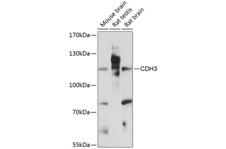 Western Blot - Anti-P cadherin Antibody (A87960) - Antibodies.com
