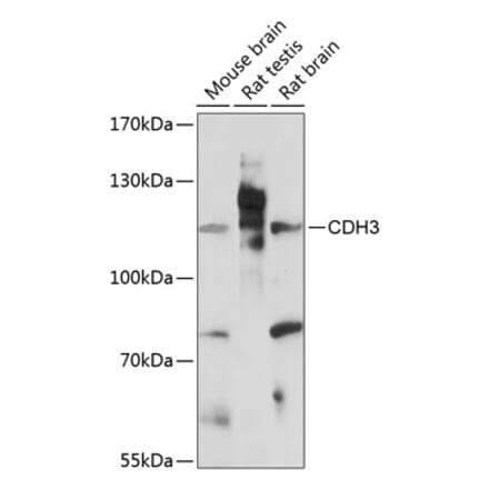 Western Blot - Anti-P cadherin Antibody (A87960) - Antibodies.com