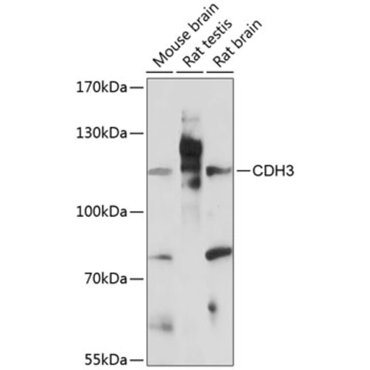 Western Blot - Anti-P cadherin Antibody (A87960) - Antibodies.com