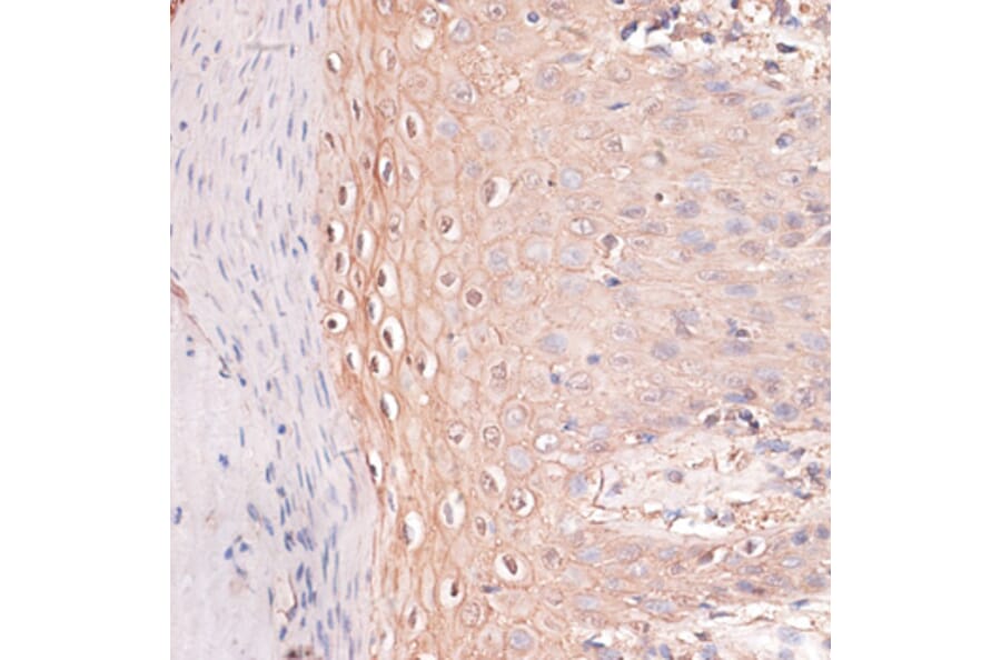 Immunohistochemistry - Anti-P cadherin Antibody (A87960) - Antibodies.com