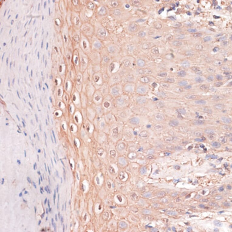 Immunohistochemistry - Anti-P cadherin Antibody (A87960) - Antibodies.com