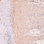 Immunohistochemistry - Anti-P cadherin Antibody (A87960) - Antibodies.com